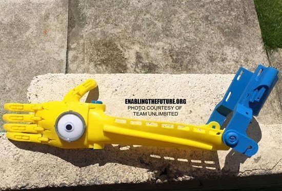 英國(guó)：為殘疾兒童設(shè)計(jì)可完全定制的3D打印假肢