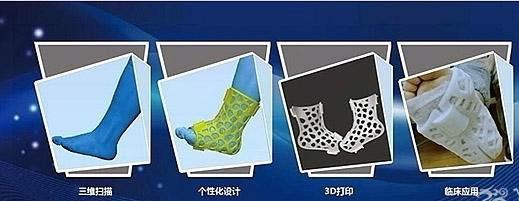 國內(nèi)首個3D打印醫(yī)療中心落戶重慶