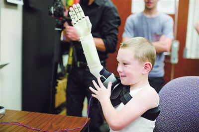 德國研究人員為戰(zhàn)區(qū)傷員開發(fā)低成本3D打印假肢