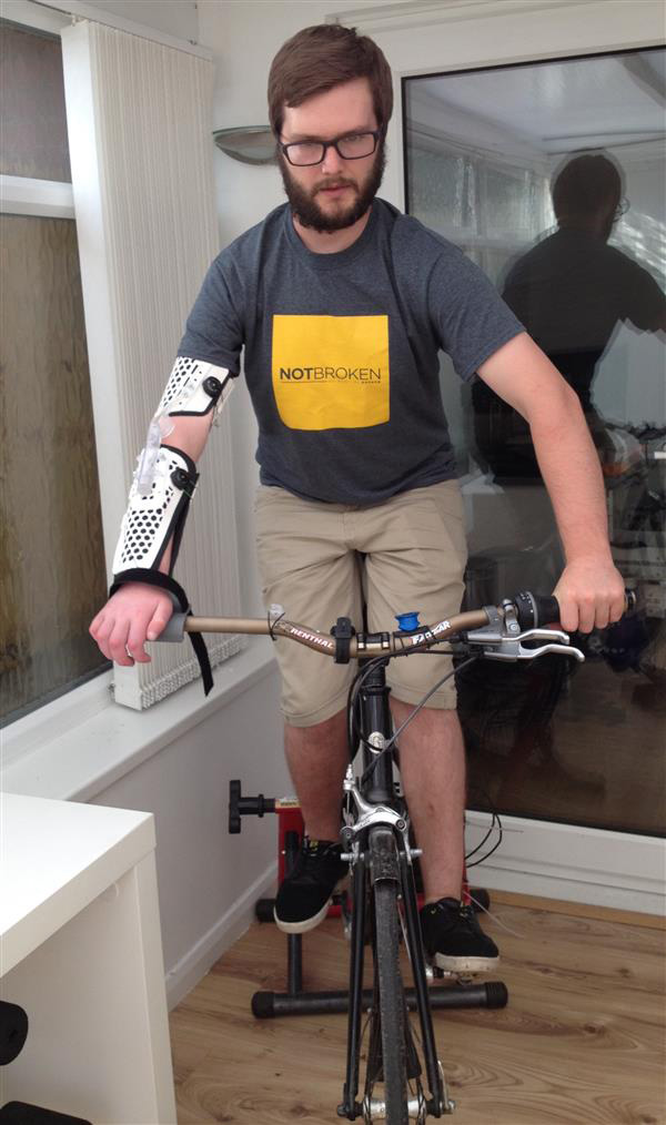 3D打印幫助右臂癱瘓的頑強(qiáng)山地車(chē)手重返賽場(chǎng)