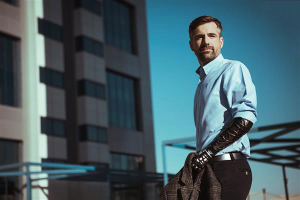 UNYQ推出美觀時尚的3D打印定制假臂外殼