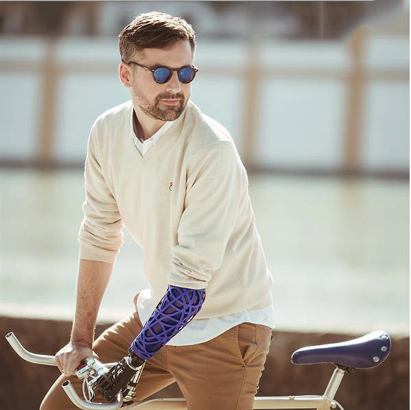 UNYQ推出美觀時尚的3D打印定制假臂外殼