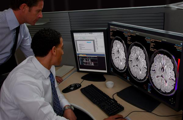 飛利浦發(fā)布其視覺分析和量化平臺的最新版本