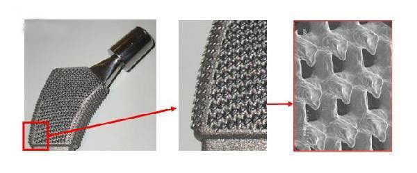 帶數(shù)百個(gè)小爪的新3D打印骨植入物使用壽命更長(zhǎng)