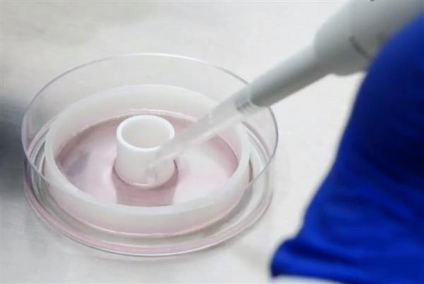 對抗心臟病的“環(huán)堆疊法”：用3D打印導(dǎo)板制作定制血管