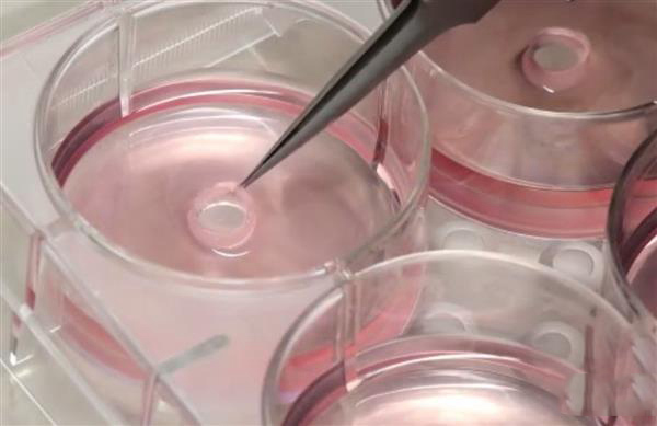 對抗心臟病的“環(huán)堆疊法”：用3D打印導(dǎo)板制作定制血管